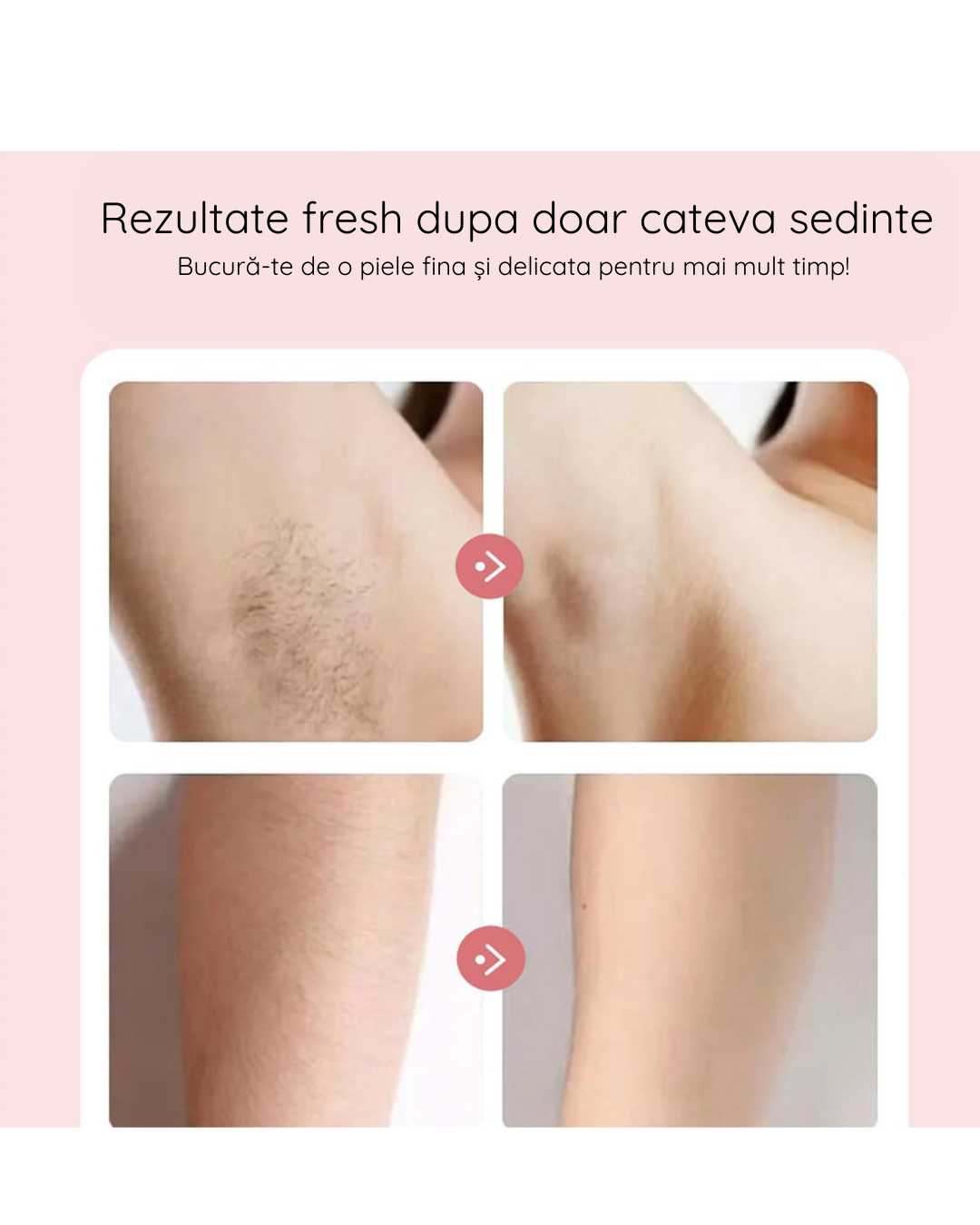 SmoothBabe - Aparat de Ras Fullbody, Rezistent la Apa