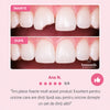 DentalFix Kit pentru Reparare Dentara Provizorie
