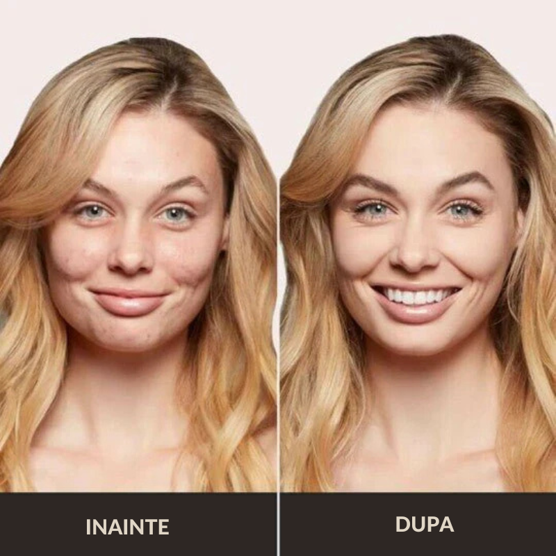 CC Cream cu Efect Matifiant - Corectare si Hidratare