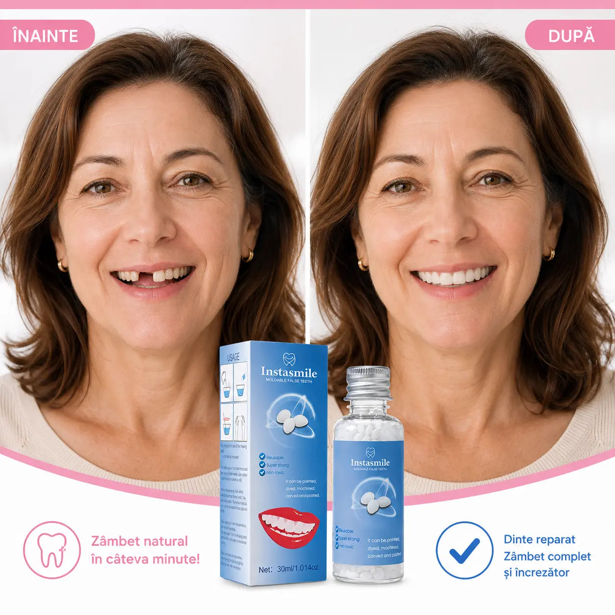 DentalFix Kit pentru Reparare Dentara Provizorie