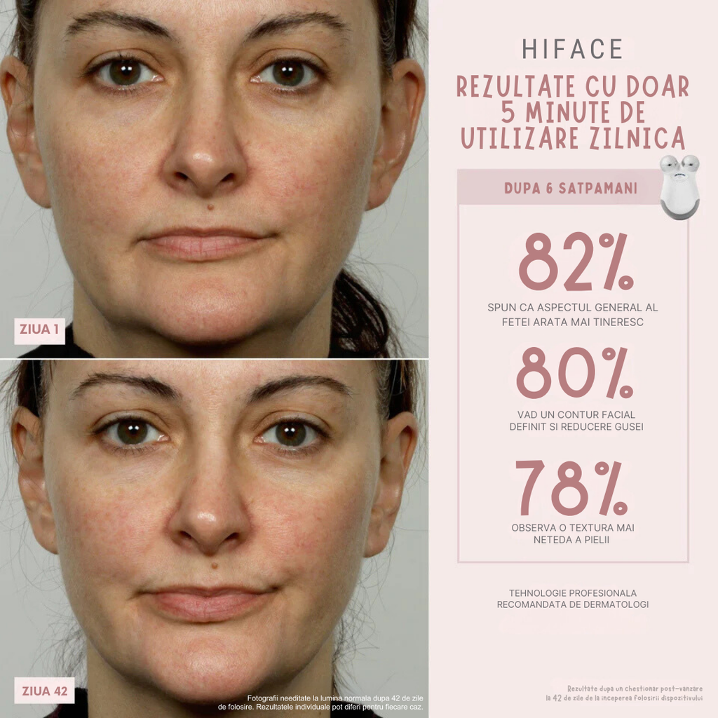 HiFace Aparat cu Microcurent pentru Remodelare, Lifting Facial si Intinerirea Pielii