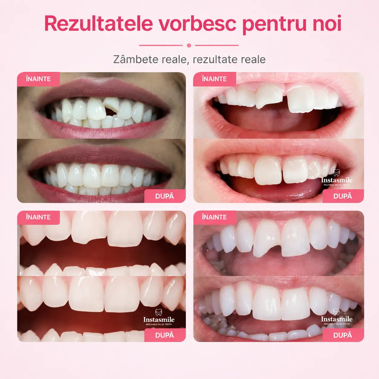 DentalFix Kit pentru Reparare Dentara Provizorie